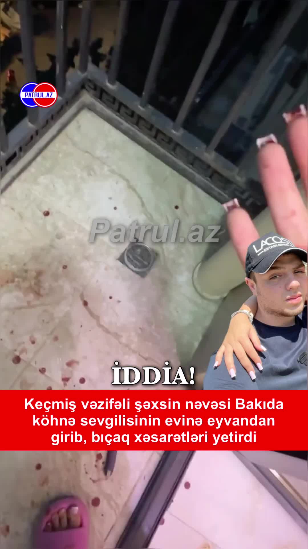 Keçmiş vəzifəli şəxsin nəvəsi, köhnə sevgilisini evində bıçaqladı