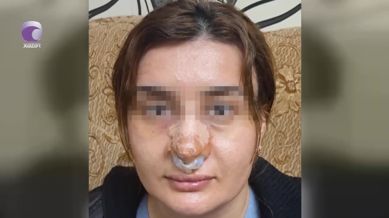 “Mərcan” klinikasının həkimi Babək Həsənlidən şikayət