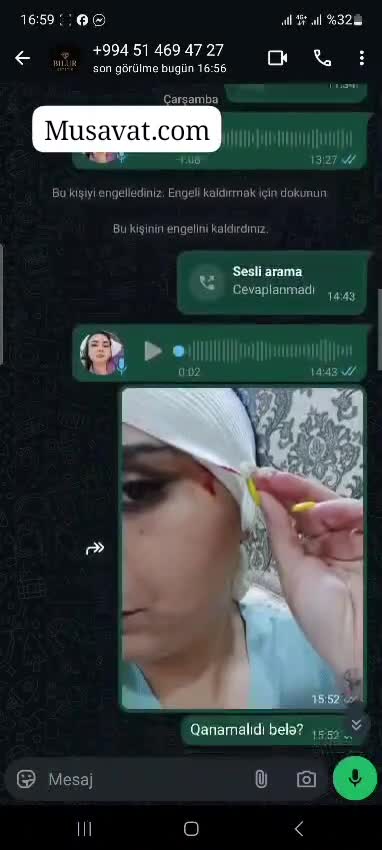 “TikTok reklamına inandım, üz sinirlərim zədələndi”