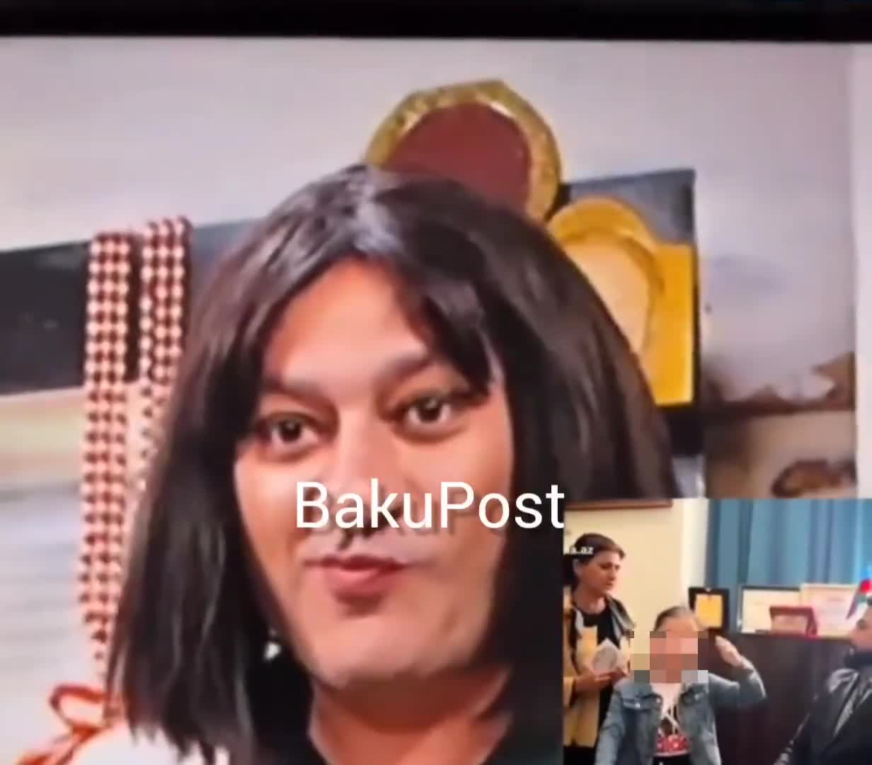 Autizmli uşağı parodiya edən aktyor tənqid olundu