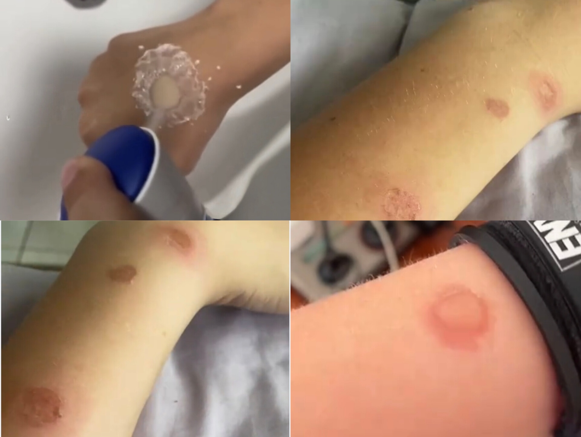 Gənclər özlərini yandırır