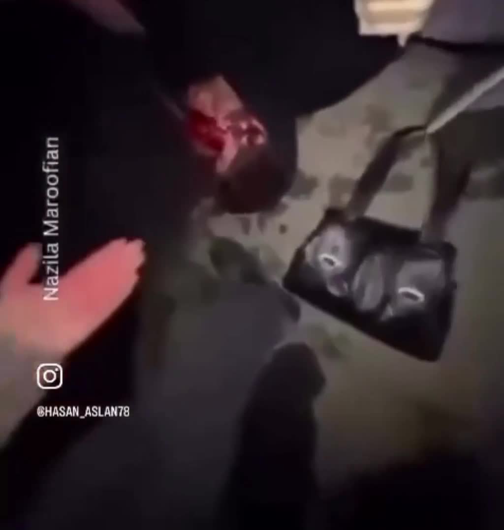 Etiraçılar qan içində