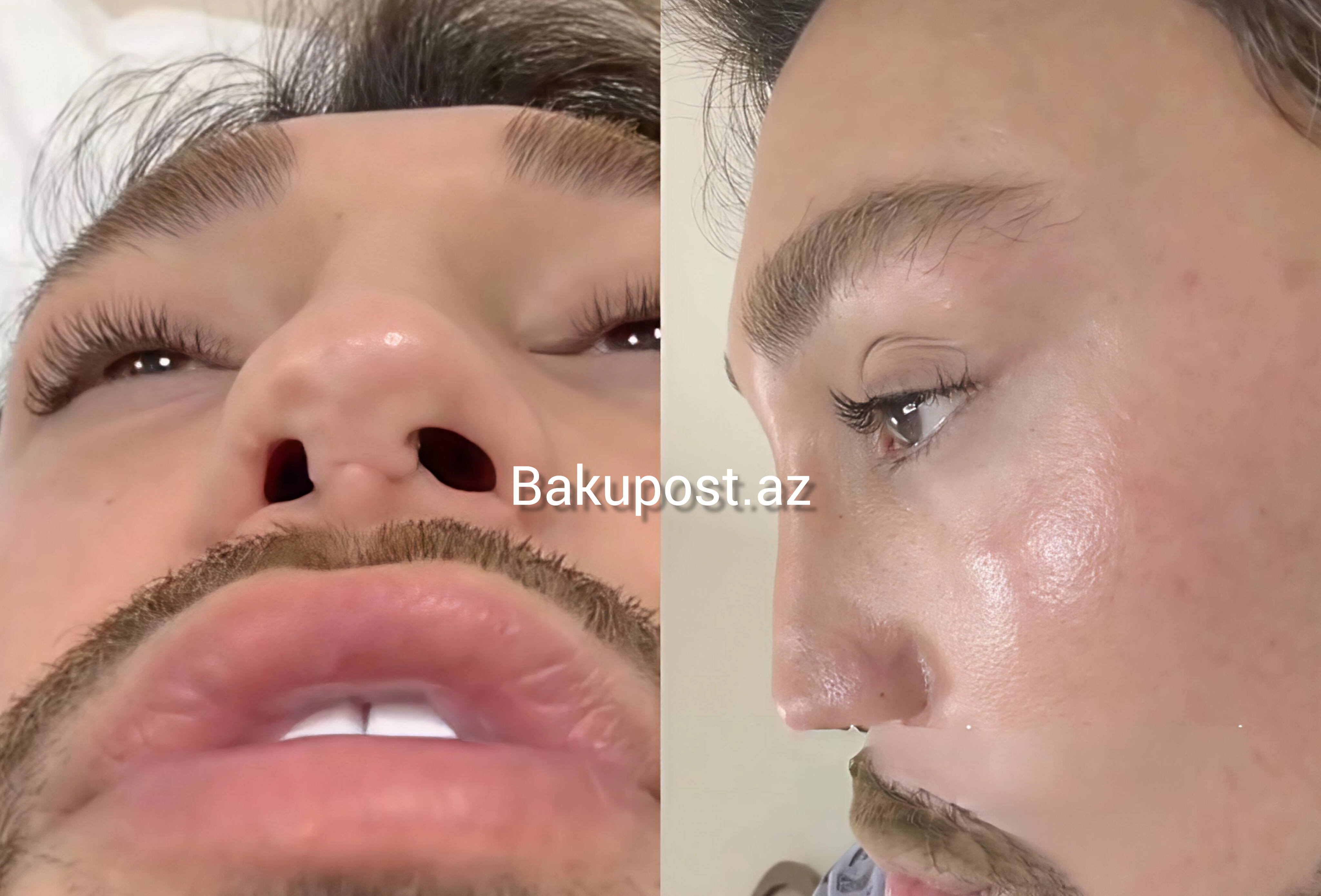 Azərbaycanın ən uğursuz plastik cərrahları