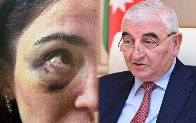 Məzahir Pənahovun oğlu boşanmaq istəmir, qızılları da qaytarmır 