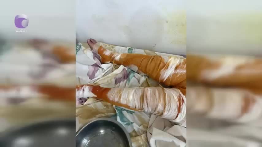 Oğul anasını yandıraraq öldürüb