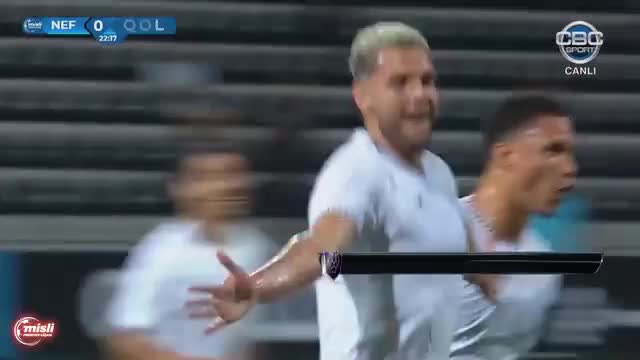 Onun qolu ən yaxşı seçildi