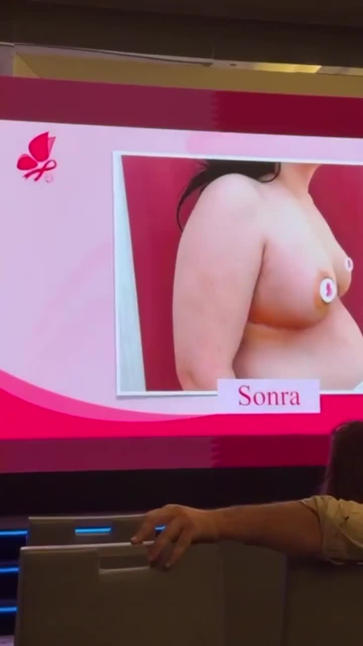 “Referans Hayat Hospital”ın həkimi konfransda iştirak etdi