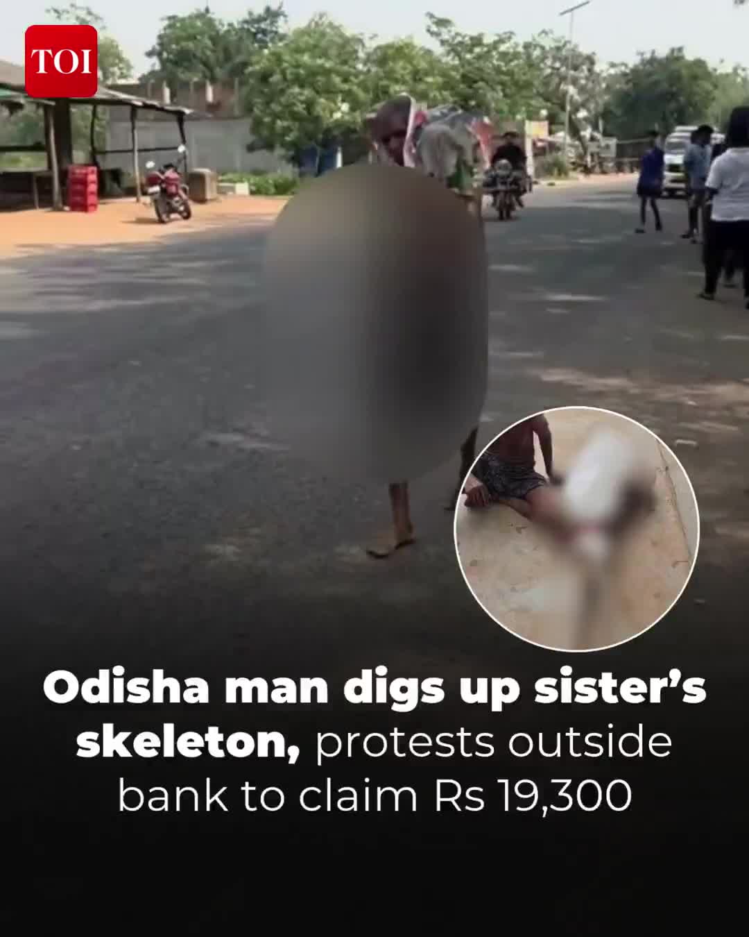 Pul almaq üçün ölən bacısının sümüklərini banka apardı