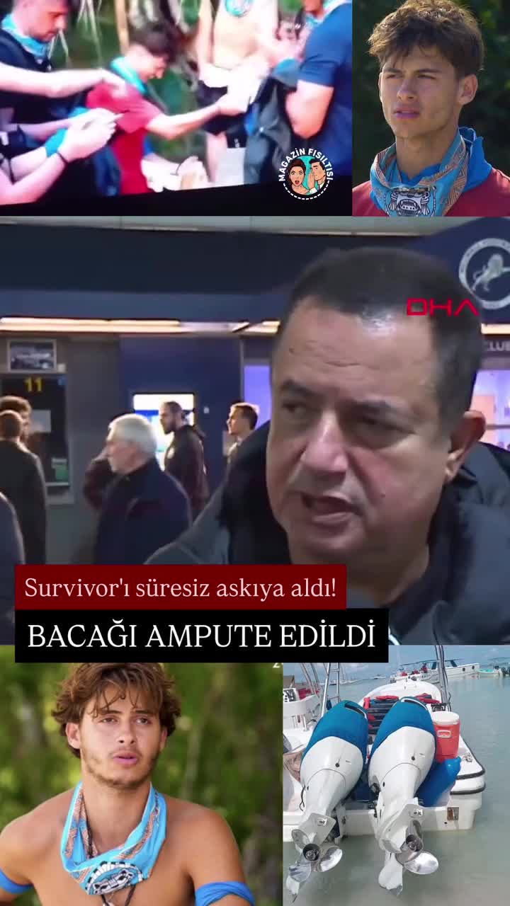 “Survivor” iştirakçısının ayağı amputasiya edildi