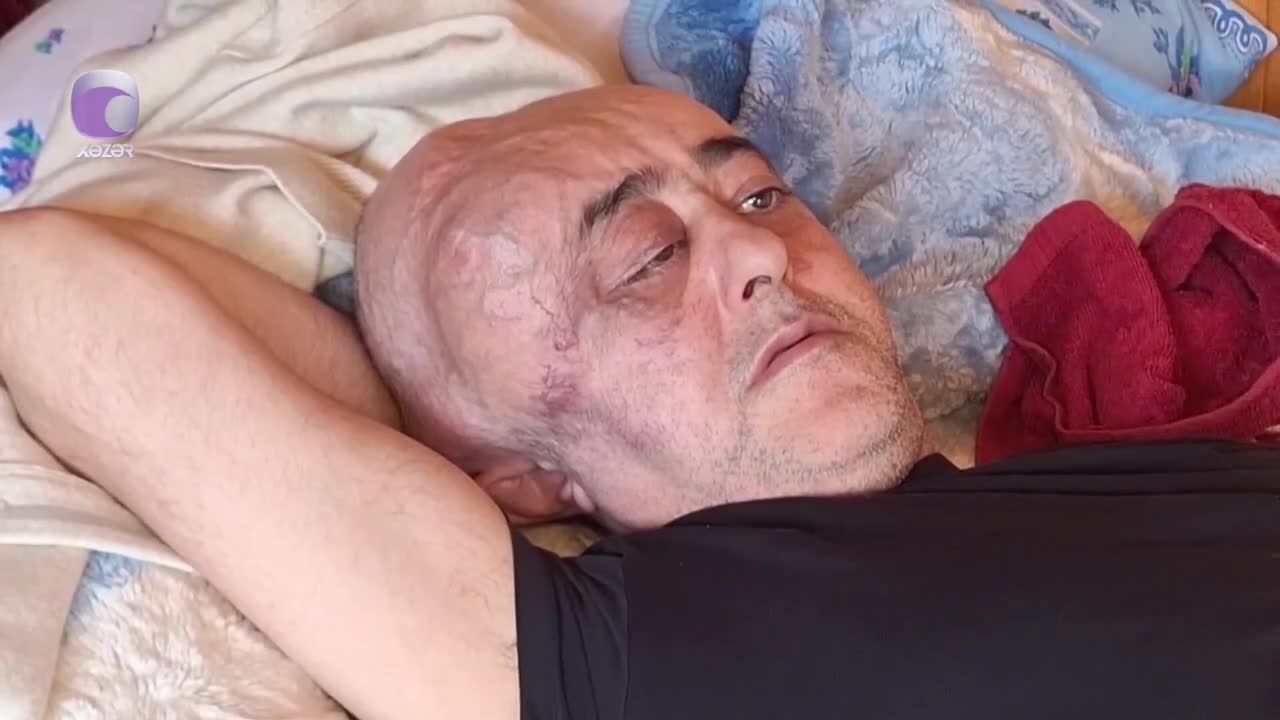 “5 ildir yataq xəstəsidir, pensiya ala bilmir”
