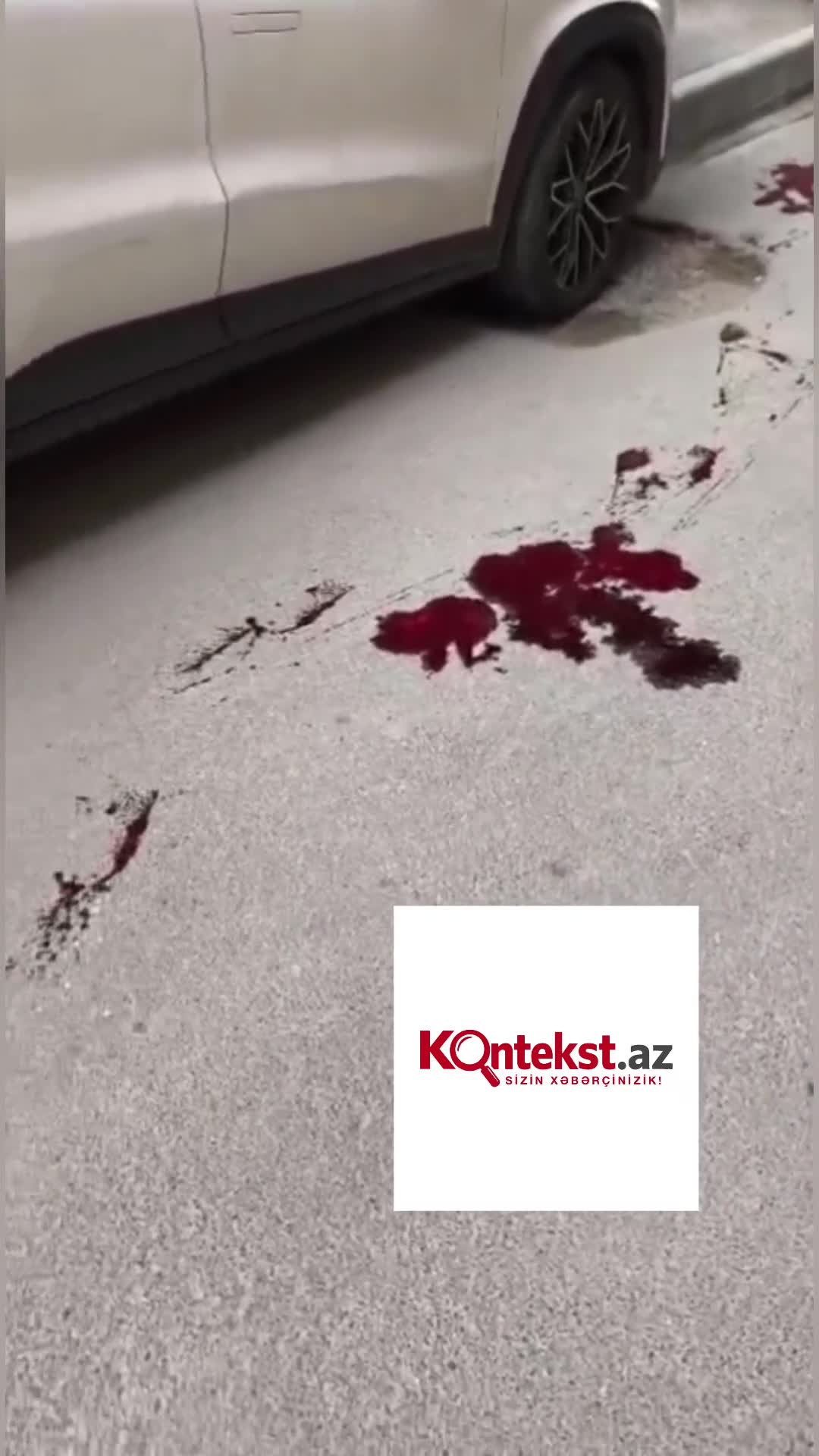 Xırdalanda küçə itləri qadına hücum etdi