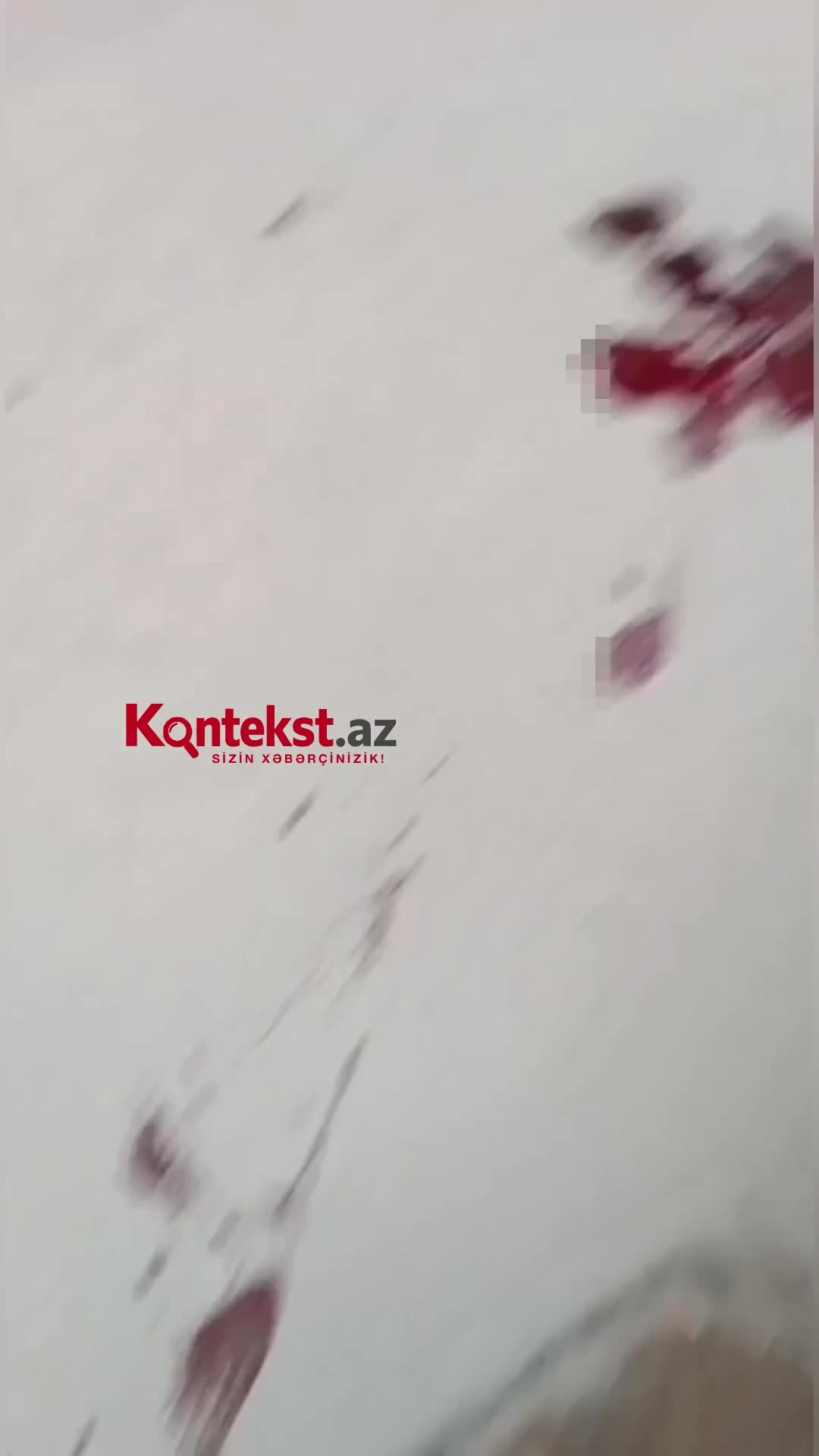 Xırdalanda küçə itləri qadına hücum etdi