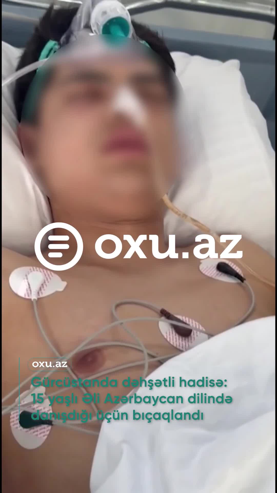 Azərbaycan dilində danışdığı üçün bıçaqlandı