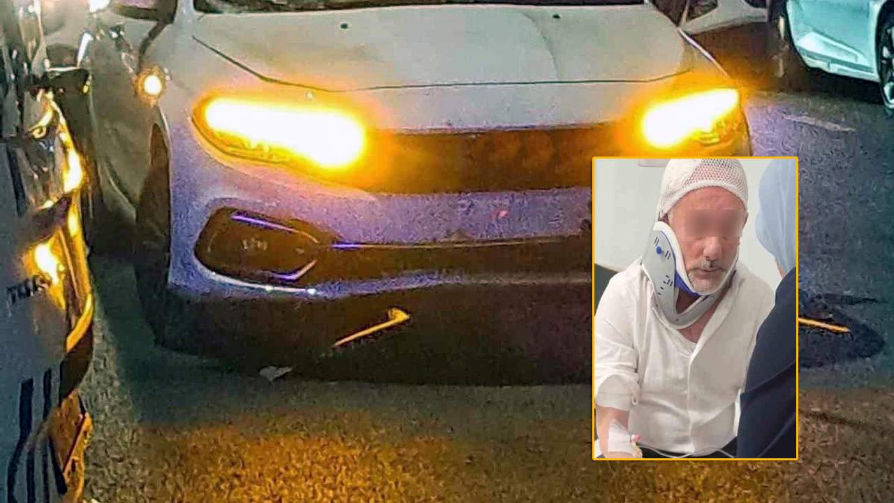 “Fiat” sürücüsü skuter sürən uşağı vurdu; ailəsi hücuma keçdi 